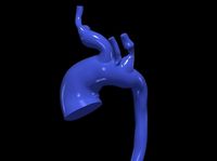 3d model of aorta | 3D