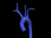 3d model of aorta | 3D