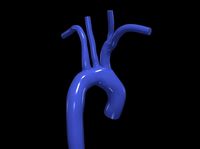 3d model of aorta | 3D