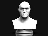 Tyson Fury 3D Printable Bust | 3D