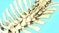 Spine Implant