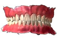 Dental model
