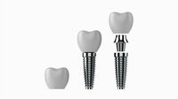 Tooth Implant
