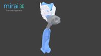 Medical Model WP6