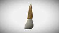 Maxillary Central Incisor