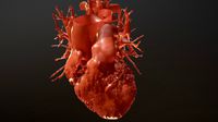 Computed Tomography Reconstruction of Heart V2