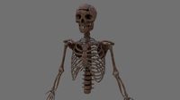Skeleton Top Half with Bullet Hole in Head