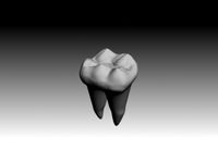 first molar mandibular.3DS