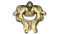 Human C2 Vertebra - The Axis