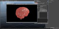 Brain