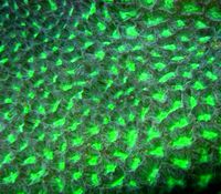 Brain Coral