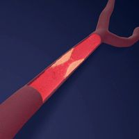 Artery with atherosclerotic plaque