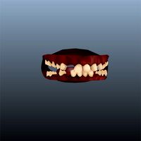 hillbilly teeth