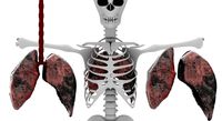 smoker lungs