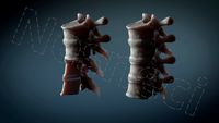 Human Vertebrae w/Cross Section T6 toT9 High Res Textures