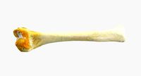 Bone
