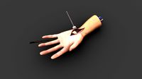 Surgical operations: