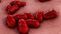 Bacterial Meningitis