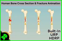 Human Bone Cross Section &amp; Fracture Animation
