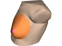 Breast