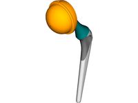 Artificial Hip