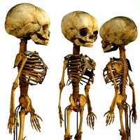 Foetus Skeleton