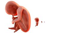 fetus simple 5 set