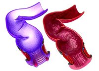 Human anatomy rectum and hemorrhoids