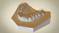 Digital Flat Plane Splint Orthodontics | 3D