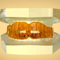 Digital Anti Snoring Splint