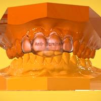 Digital Anti-Migraine Appliance