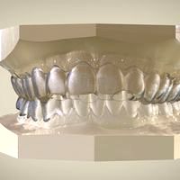 Digital Tooth Positioner