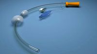 Nasogastric feeding Tube