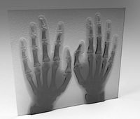 xray hand model