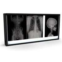 XRay Light Box