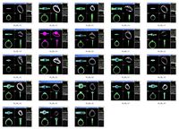 Collection- Bulk Rings-0038-3dm without stones-22 Files | 3D