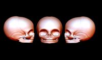 A baby basic head Skeleton | 3D