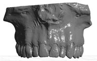 UpperJaw