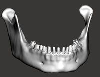 Human mandibular jaw with typodont | 3D