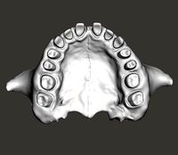 Human maxillary jaw with typodont  | 3D