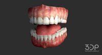 Gums Teeth and Tongue