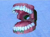 Peritonsillar Abscess Trainer