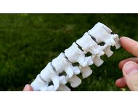 Spine Model from CT Scan / Printable Medical Model by AndrewSink