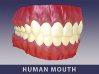 Full Mouth Set