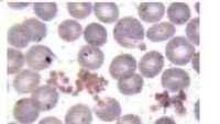 PLATELET