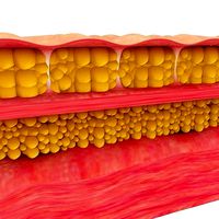 cellulite