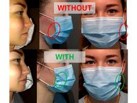 Surgical mask retractor COVID19 / Ecarteur de masque chirurgical by ALTYLAB