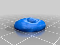 Stoma by 3DMedLab