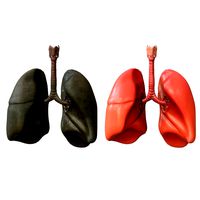 Lungs Human Smoker vs Non Smoker