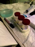 Biopsy flask holder by oricardomiranda